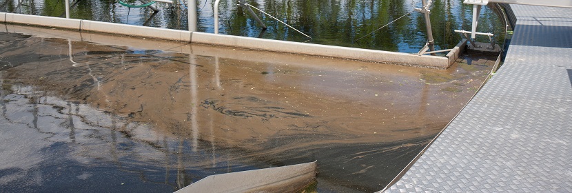 同工酶檢測(cè)
